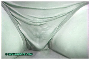 06-see-thru-xray-070